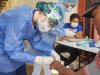 Ante la presencia de la viruela símica en Colombia, ten en cuenta
