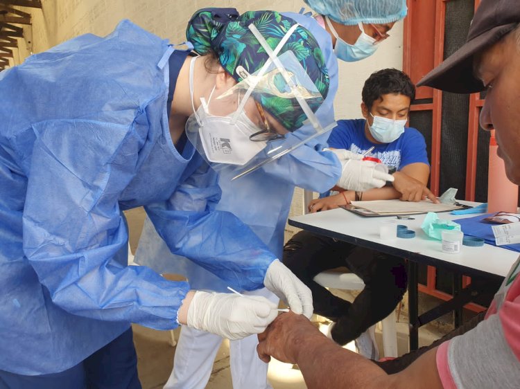 Ante la presencia de la viruela símica en Colombia, ten en cuenta